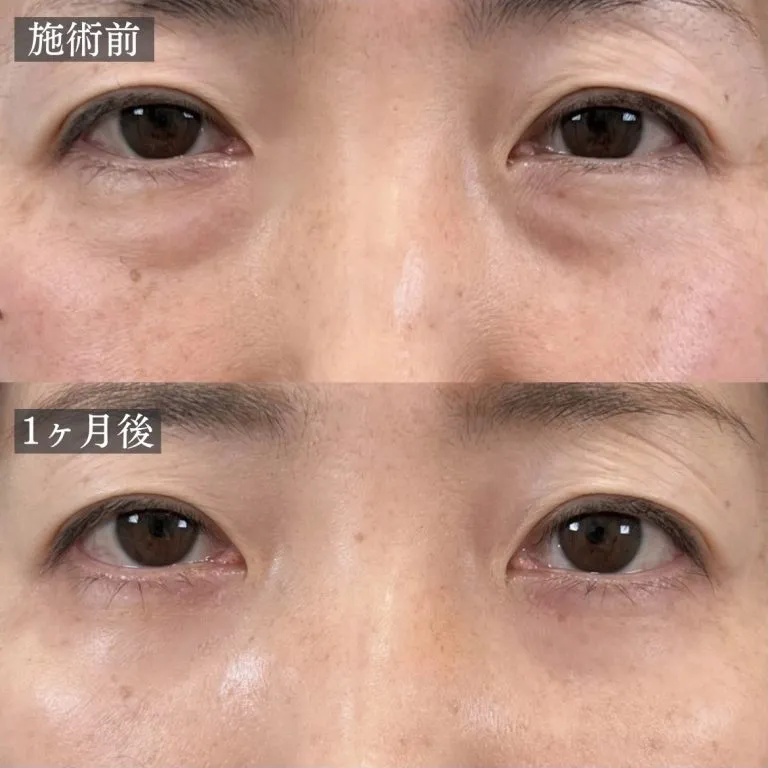 症例写真
