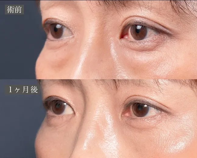 症例写真