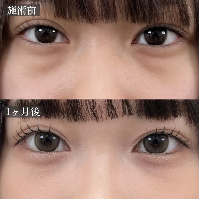 症例写真