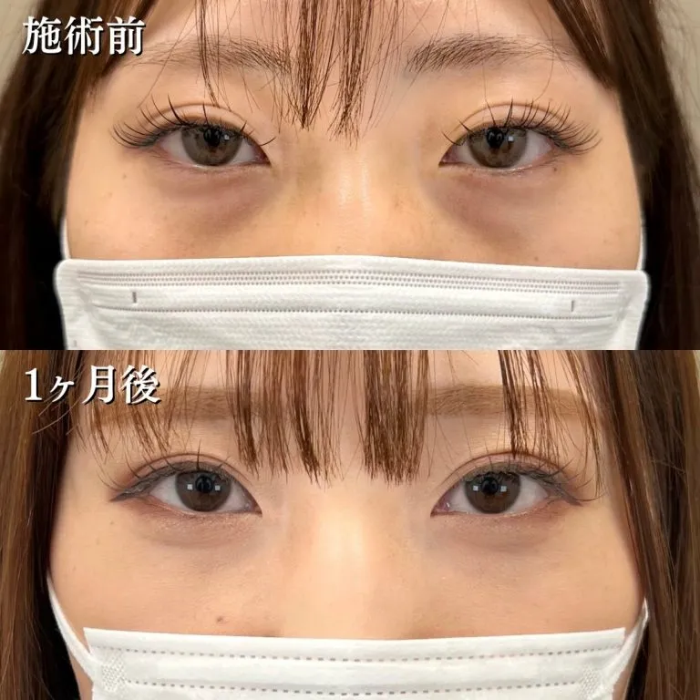 症例写真