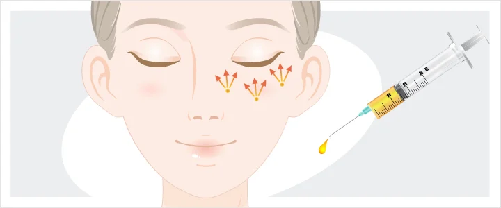 Facial Fat Injection (Nano Fat 2.0) Treatment Process