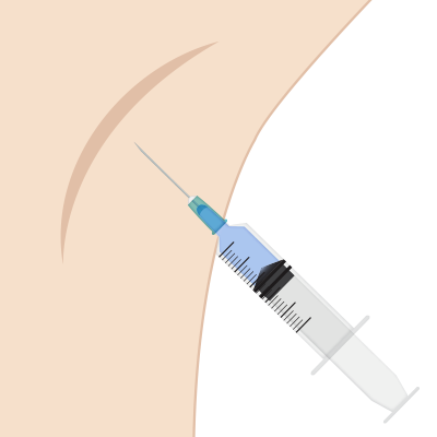 Hyperhidrosis Botox Injection Image