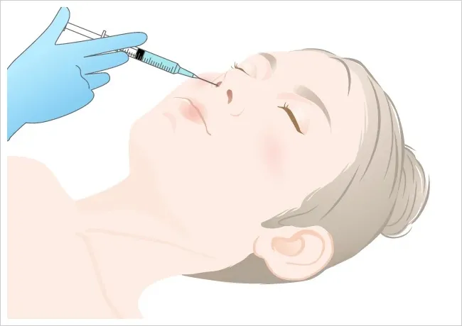 Intranasal Drip Method Image