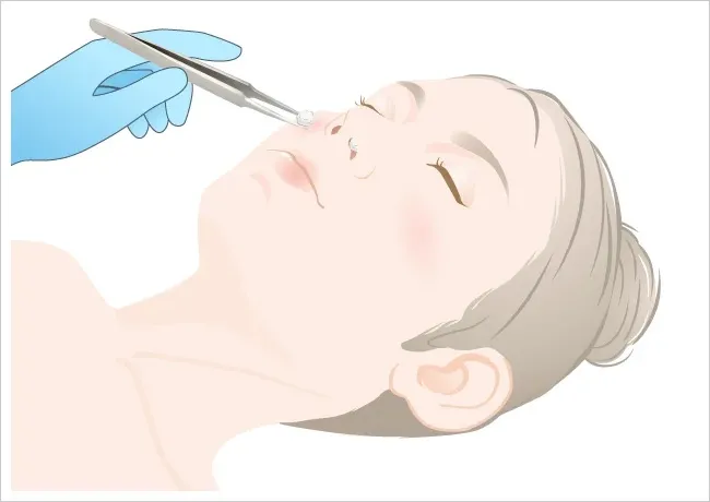 Gauze Packing Method Image