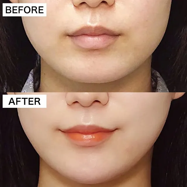 Before & After Photo