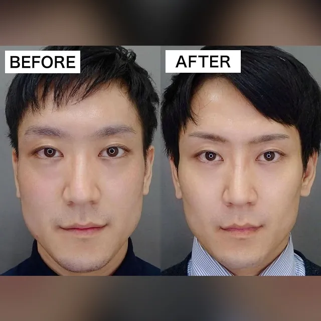 Before & After Photos