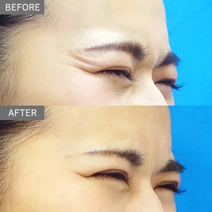 Before & After Photos