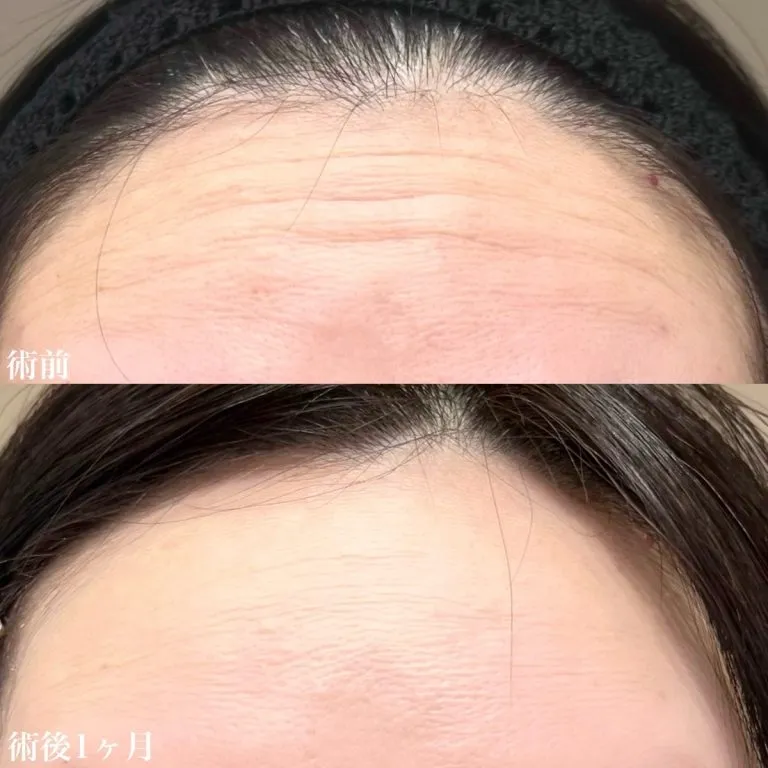 Before & After Photos