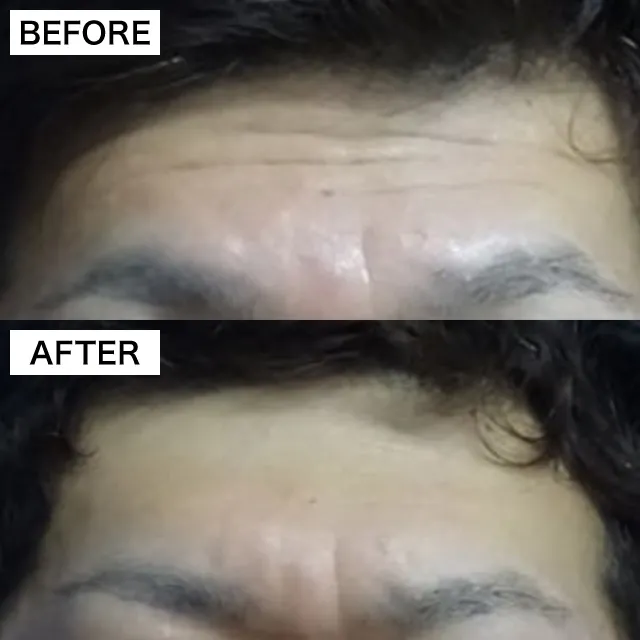 Before & After Photos