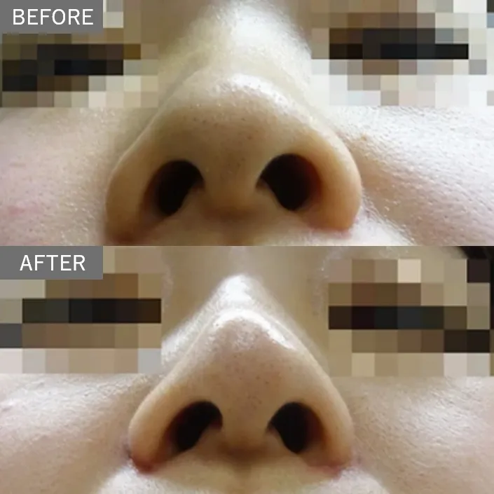 Before & After Photos