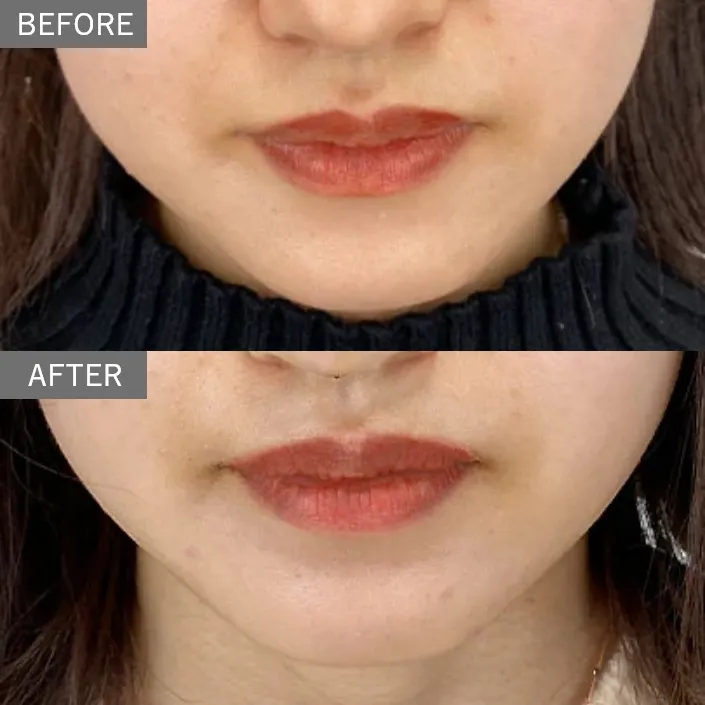Before & After Photos