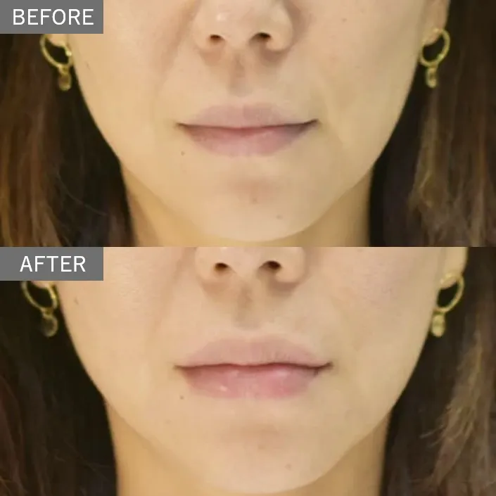 Before & After Photos
