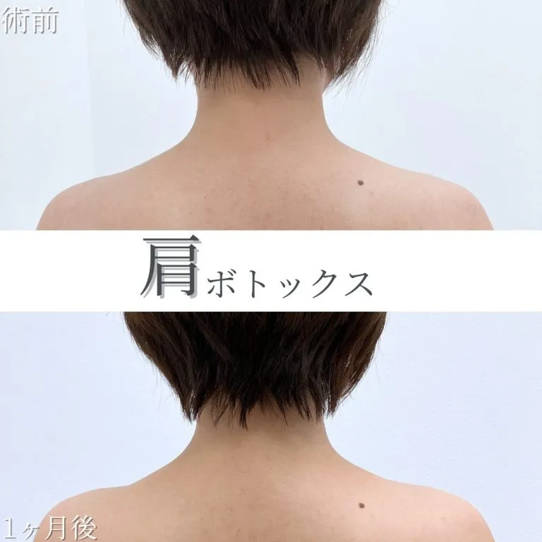 Before & After Photos