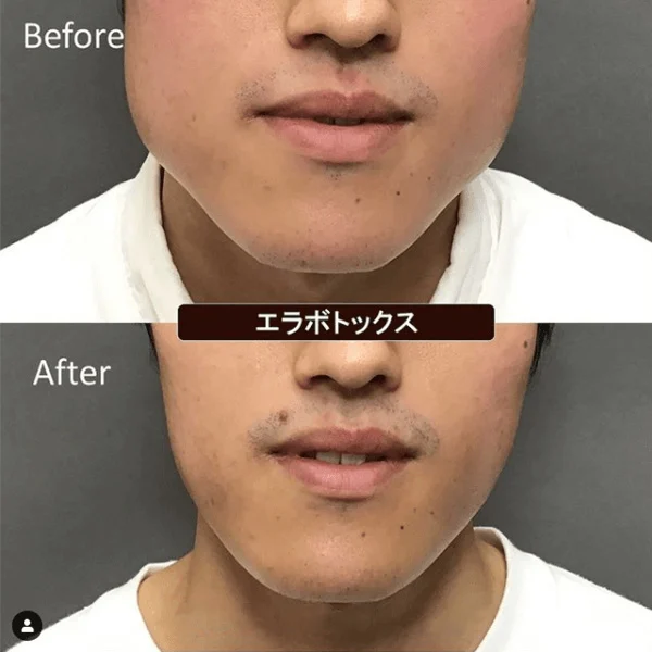 Before & After Photos