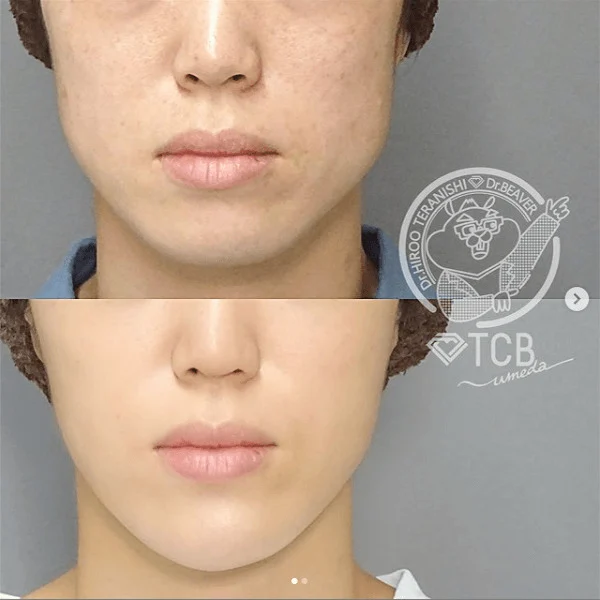 Before & After Photos