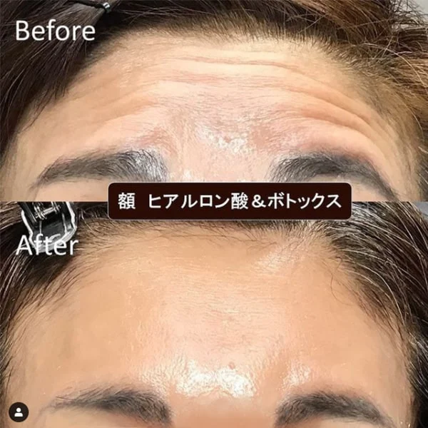 Before & After Photos