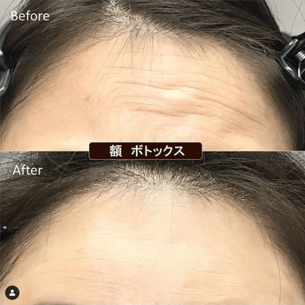 Before & After Photos