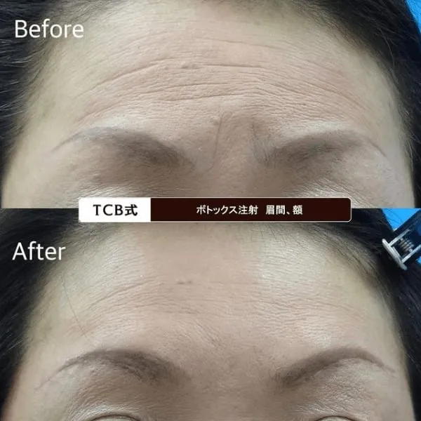 Before & After Photos