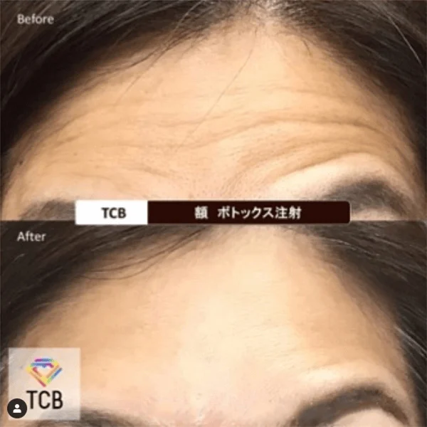 Before & After Photos