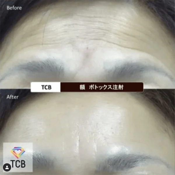Before & After Photos