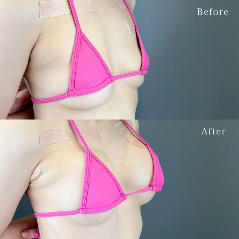Before & After Photos