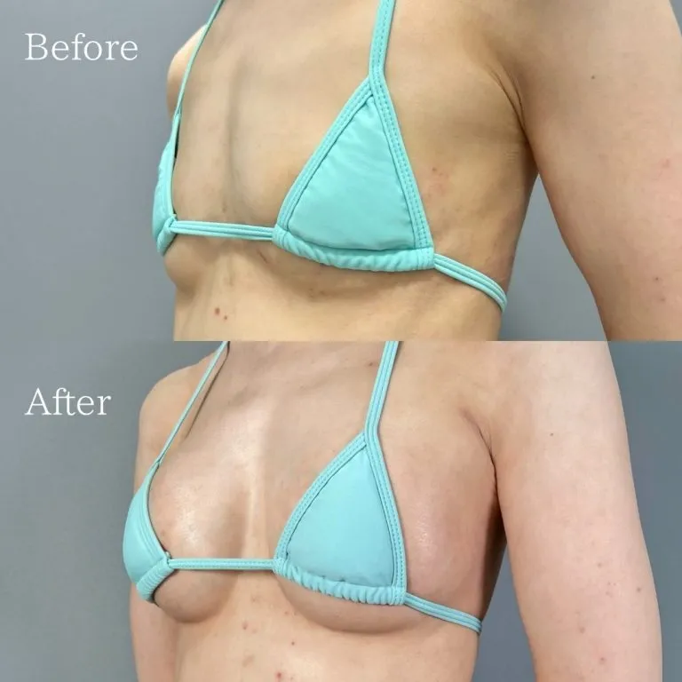 Before & After Photos