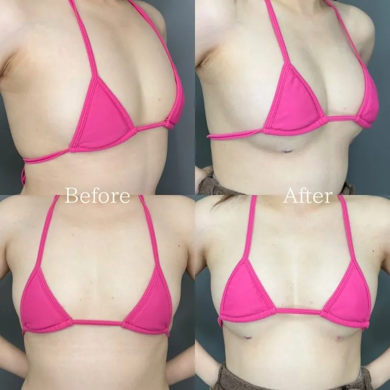 Before & After Photos
