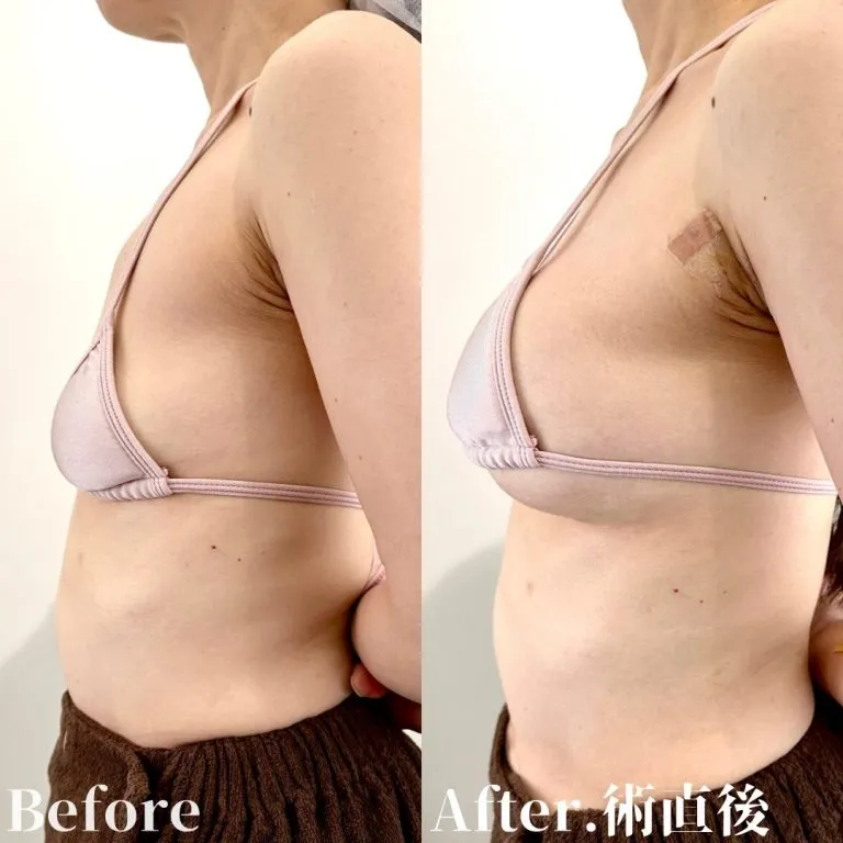 Before & After Photos