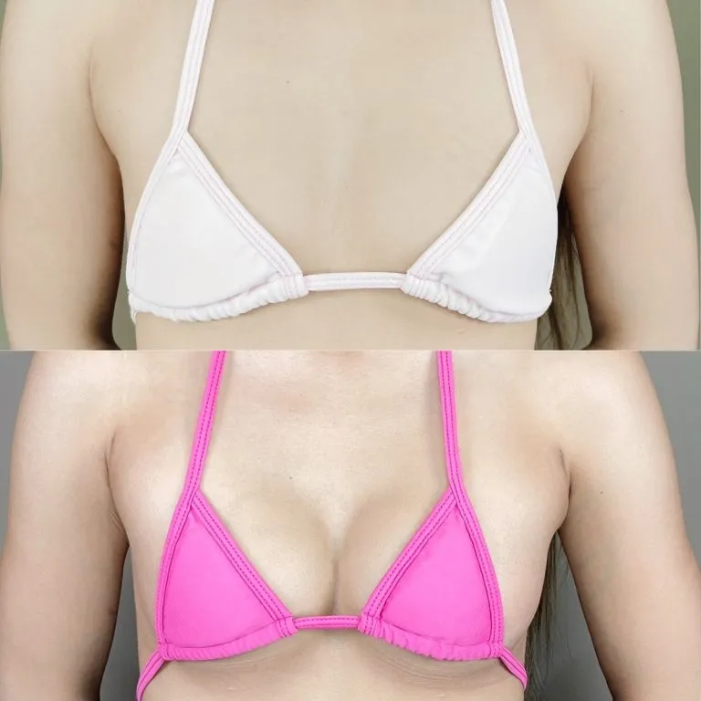 Before & After Photos
