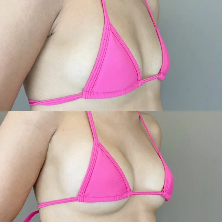 Before & After Photos