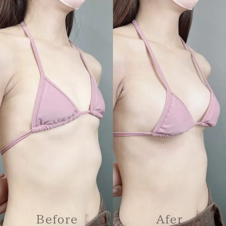 Before & After Photos