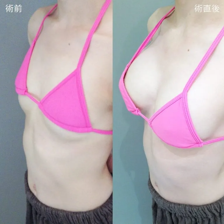 Before & After Photos