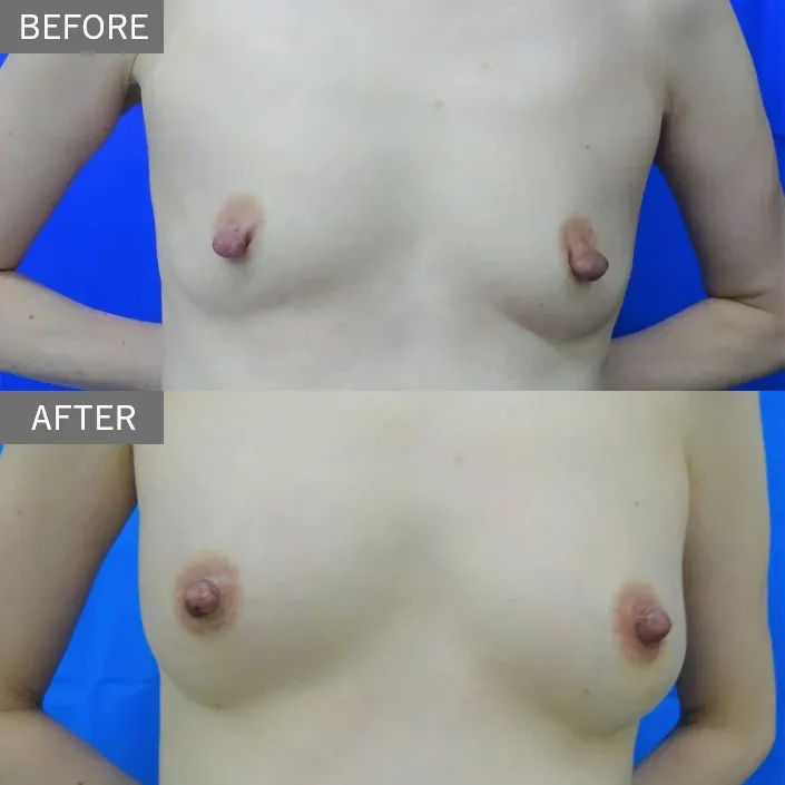 Before & After Photos