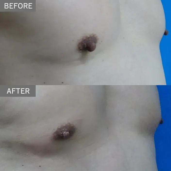 Before & After Photos