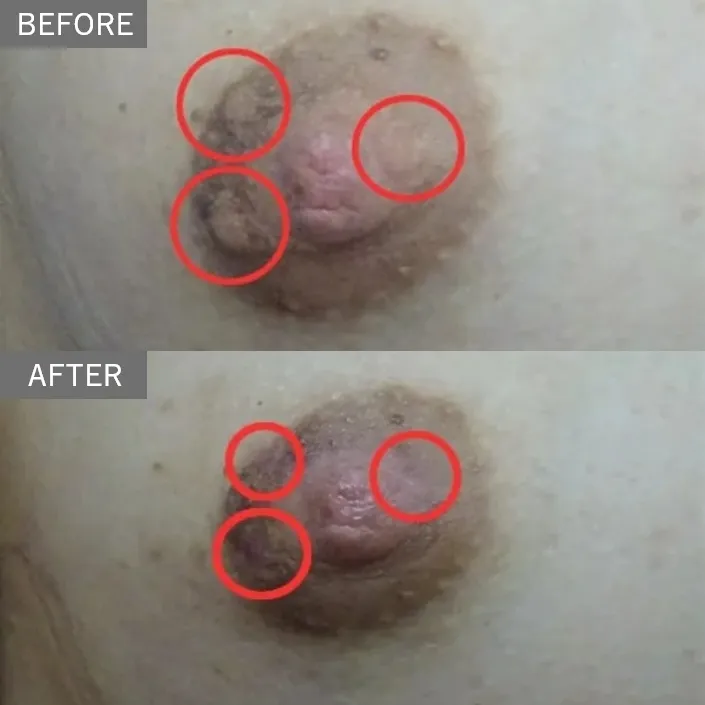Before & After Photos
