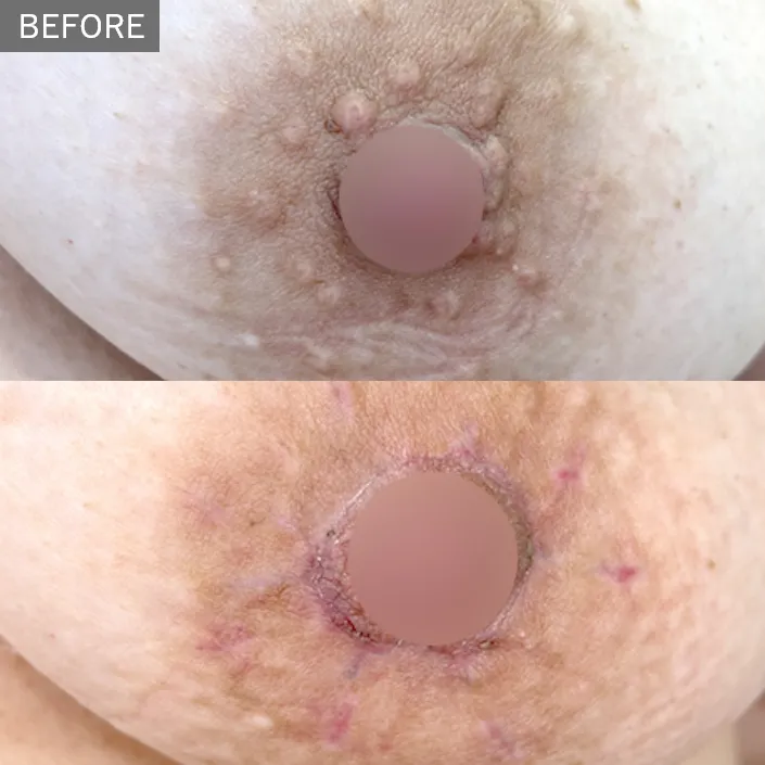 Before & After Photos