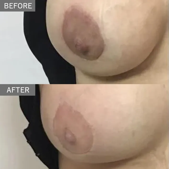 Before & After Photos