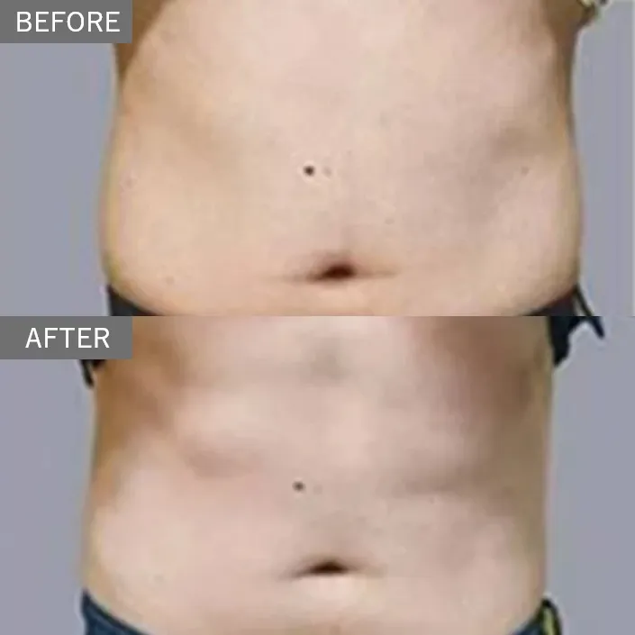 Diet Sculpt