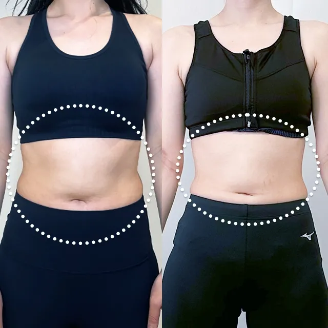 Beauty Slim Program