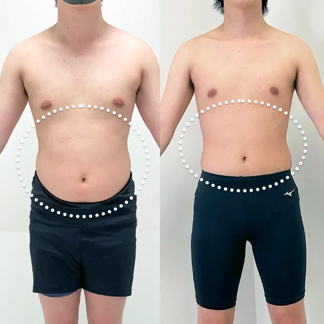 Beauty Slim Program Before & After Photos
