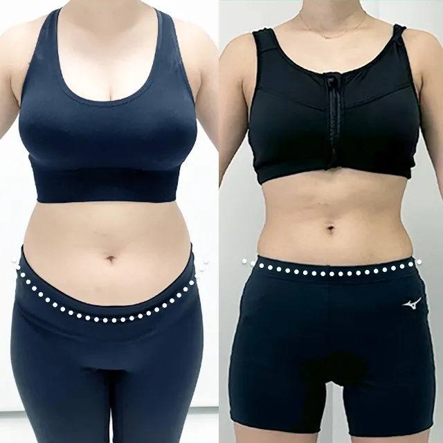 Beauty Slim Program Before & After Photos