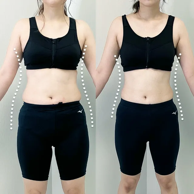 Beauty Slim Program Before & After Photos
