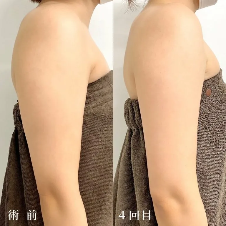 VFDI Ginseng Injection