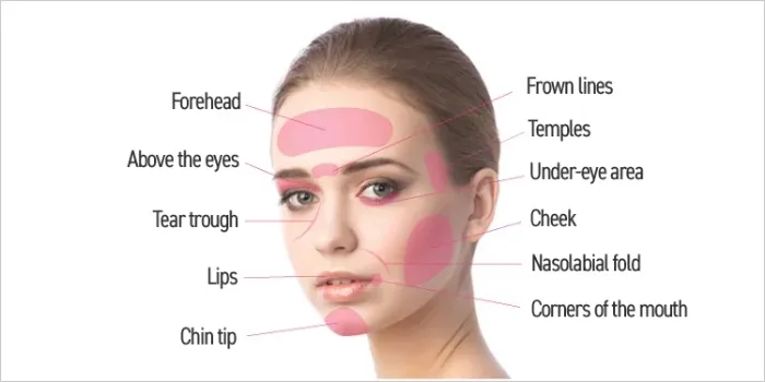 Facial Fat Injection (Nano Fat 2.0)