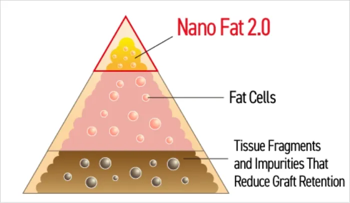 Facial Fat Injection (Nano Fat 2.0)