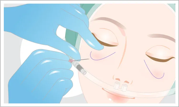 Anesthesia and Injection Site Preparation