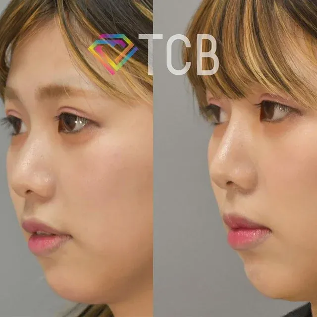 TCB Mesh_before