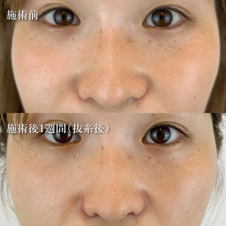Before & After Photos