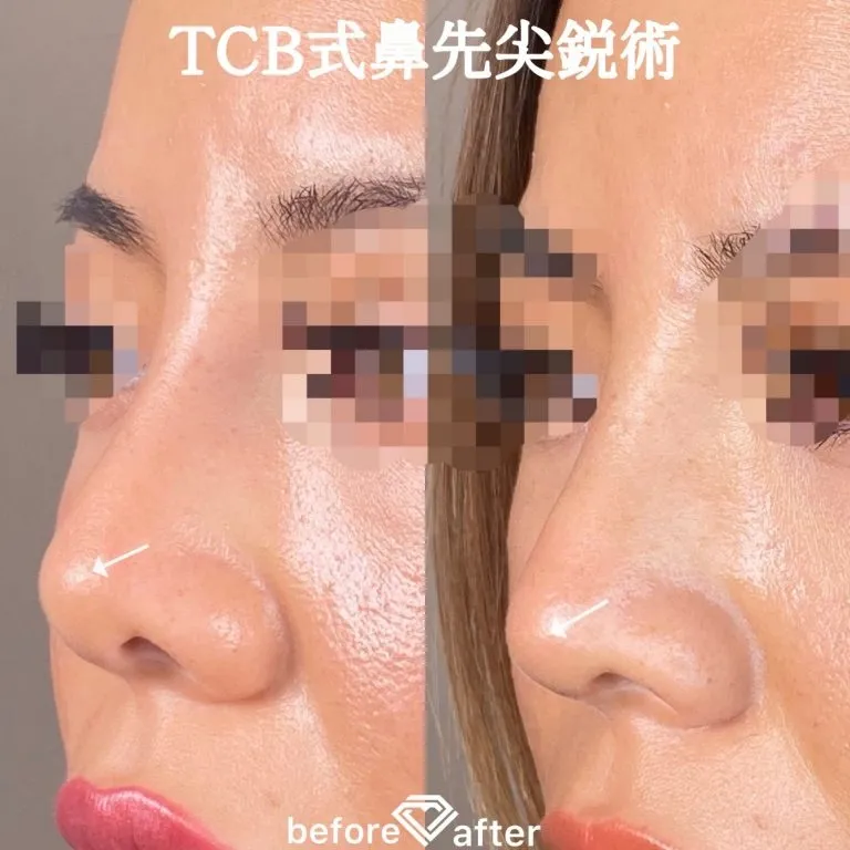 Before & After Photos