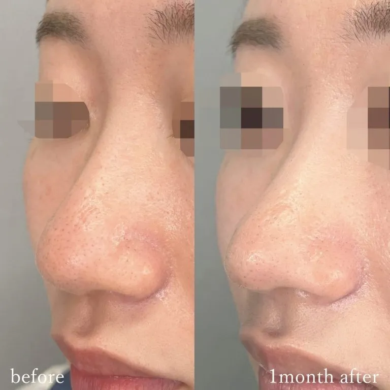 Before & After Photos